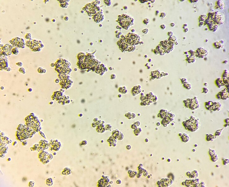 Foto esferoides de cultura de células de glioblastoma