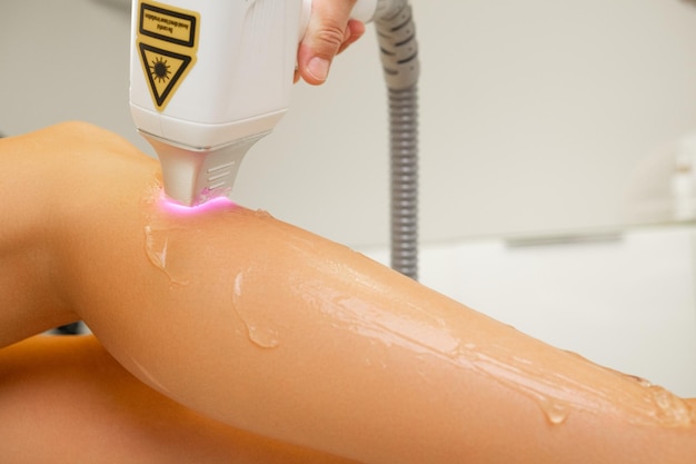 Especialista conduce un dispositivo de depilación láser en la pierna de una mujer en la oficina concepto de procedimiento en el salón de spa