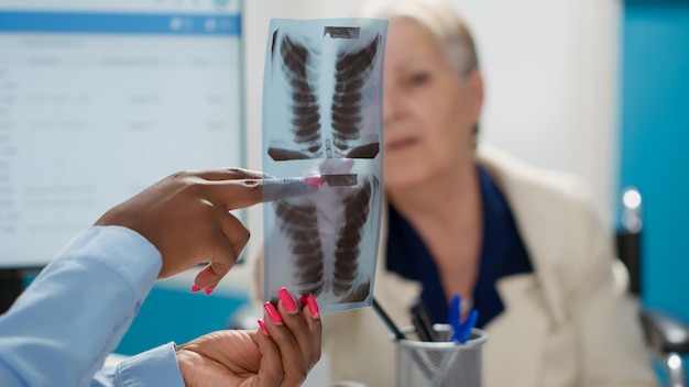 Especialista em saúde explicando os resultados da varredura de raio-x para paciente idoso, encontrando diagnóstico de ossos na visita de check-up. Médico mostrando radiografia para mulher com deficiência crônica na consulta. Fechar-se.