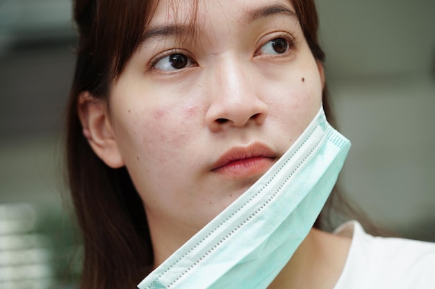 Espuma de acne e cicatriz em distúrbios de rosto de pele de glândulas sebáceas problema de beleza de cuidados com a pele de adolescente