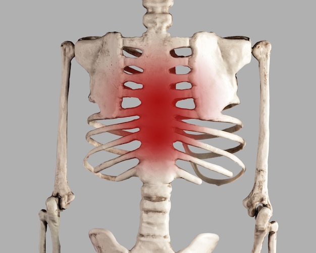 Esqueleto con punto rojo en el esternón Dolor en el pecho y las costillas Costocondritis Problemas de salud concepto de condiciones médicas