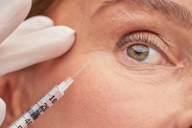 Esteticista com luvas de proteção segurando uma seringa perto de um olho feminino
