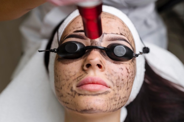 Esteticista haciendo pelado de carbono de hardware a un cliente joven y hermoso en un tocado con gafas acostado en un sofá en un salón de belleza Concepto de limpieza facial Servicios de cosmetología