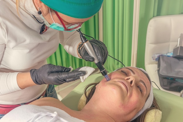 Esteticista realiza um tratamento de mesoterapia com agulha no rosto de uma mulher.