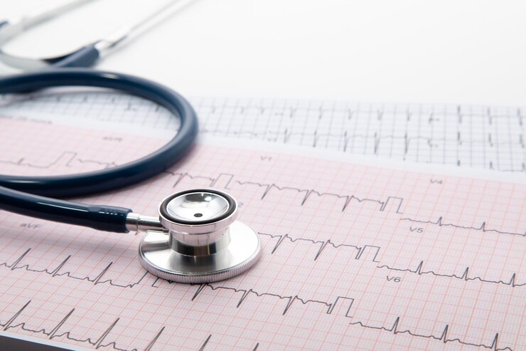 Estetoscopio azul en papel de gráfico de electrocardiograma (ECG). Escaneo de gráfico de corazón de ECG aislado en blanco. Seguro de salud y antecedentes médicos.