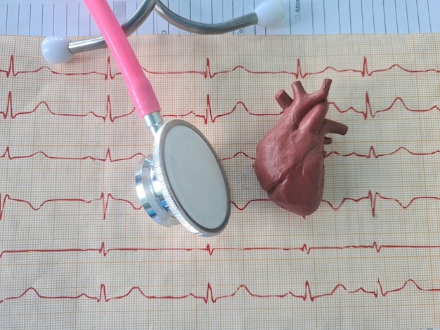 Foto estetoscopio en electrocardiograma ecg con onda cardíaca cardiograma de ataque cardíaco