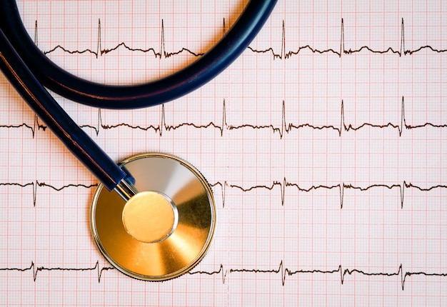 Estetoscopio en electrocardiograma