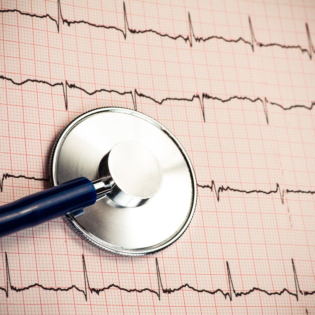 Estetoscopio en electrocardiograma