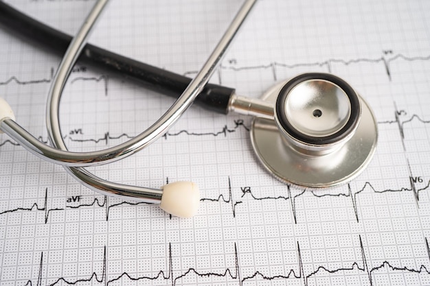 Estetoscópio no eletrocardiograma ECG onda cardíaca ataque cardíaco relatório de cardiograma