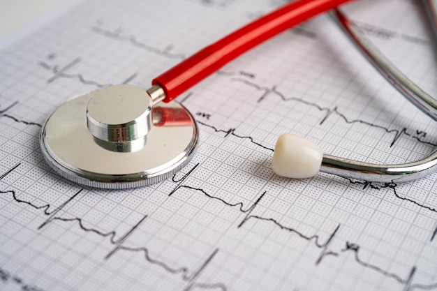 Estetoscópio no eletrocardiograma ECG onda cardíaca ataque cardíaco relatório de cardiograma