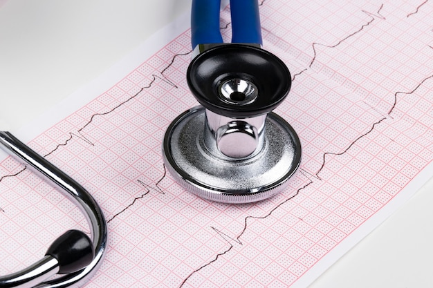 Estetoscópio no gráfico de eletrocardiograma (ecg). conceito de medicina. fundo de saúde