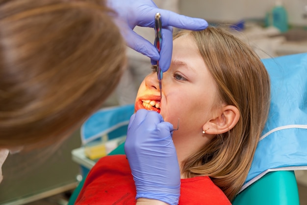 La estomatología revisa los dientes de un niño, una niña en una recepción para estomatología