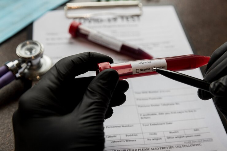 Exame de coronavírus com resultado positivo em um tubo de sangue em um fundo de ficha de registro