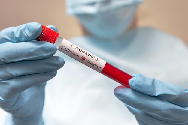 Exame de sangue negativo para coronavírus Médico em máscara médica e luvas de látex segura um tubo de ensaio com sangue