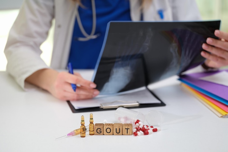 Foto examen médico exhaustivo diagnóstico de gota y varias opciones de tratamiento disponibles