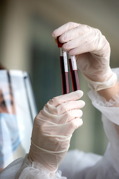 Exames de sangue para doença coronavírus. uma enfermeira trabalha durante uma pandemia cobiçosa 19