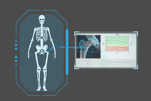Foto examina una placa holográfica digital tecnológica que representa los resultados del cuerpo del paciente de la densitometría concepto de medicina futurista concepto de tecnología médica