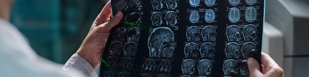 Examining medical scans on transparent lightboard