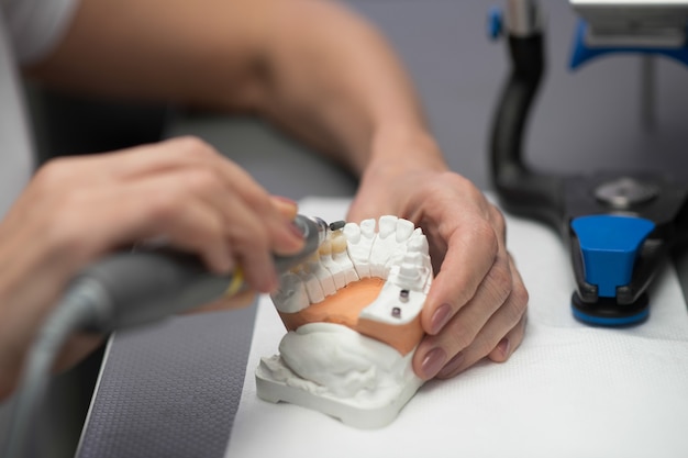 Un experto que trabaja con prótesis de yeso en el consultorio dental.