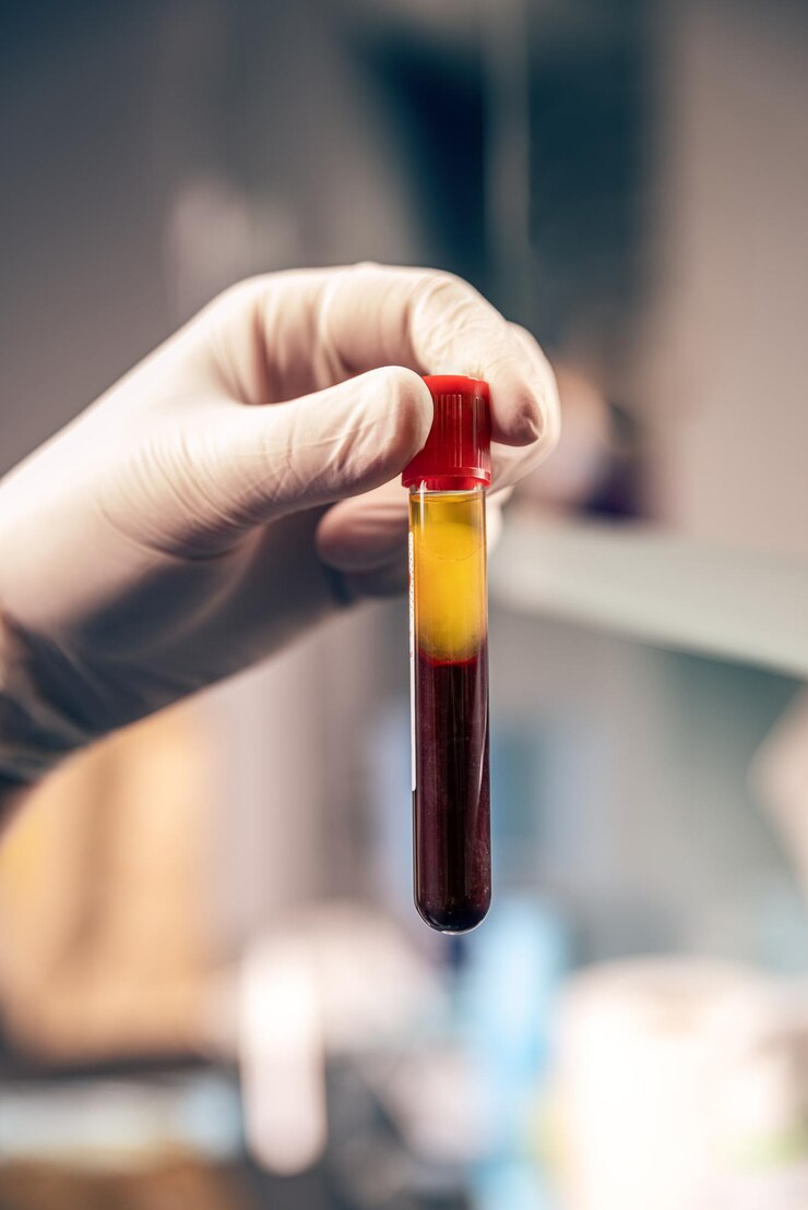 Extracción de plasma de la sangre