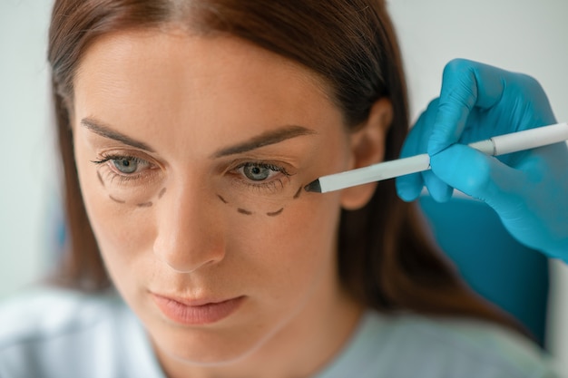 Facelifting. Kosmetikerin, die Linien auf dem Gesicht der Frau für Hebeverfahren zeichnet