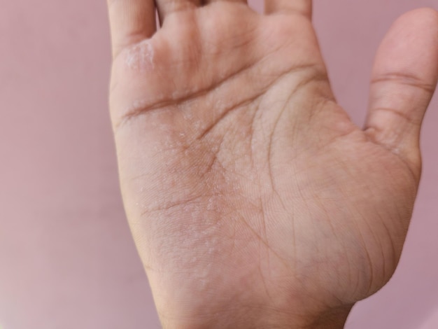 Faltige Hände nach dem Schwimmen Fingern werden nach dem Baden so faltig