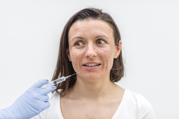 Foto fechar foto de mulher com pele seca e mão em luva médica com injeção