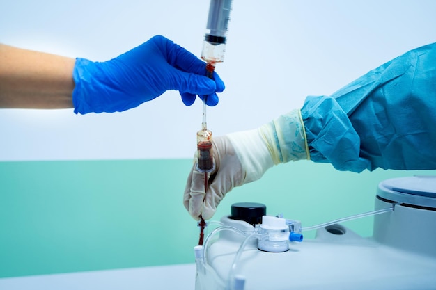 Feche a mão do assistente de laboratório segurando o saco de sangue vermelho e a seringa no laboratório da unidade de banco de sangueSalvar vida e conceito de tratamento médico Foto recortada Closeup