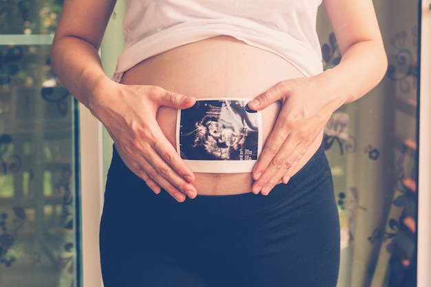 Feche a mão, grávida, mulher, segurando, ultra-som, varredura, barriga