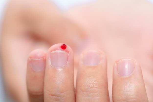 Feche acima da gota de sangue no dedo paciente da mulher - conceito da análise de sangue.