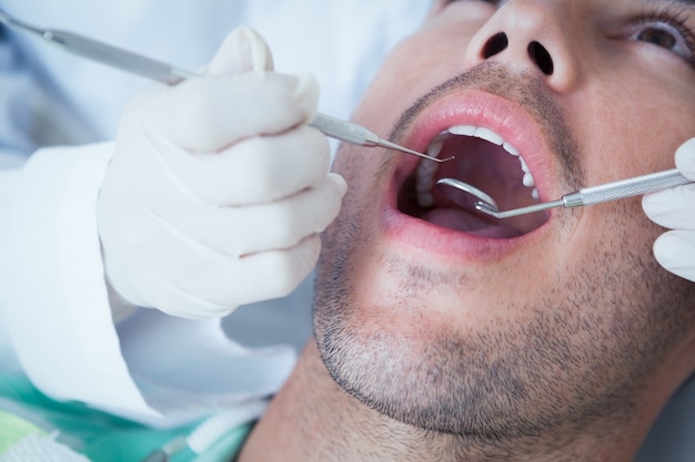 Feche o homem com os dentes examinados