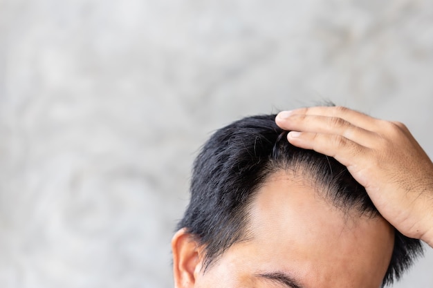 Feche o homem tocando sua cabeça para mostrar a cabeça careca ou o problema de Glabrous.