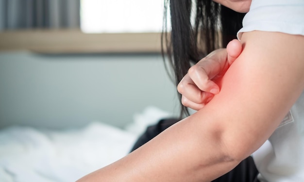 Feche o pescoço da mulher coce a coceira com a mão em casa comichão devido à erupção cutânea alergia ao fungo doença dermatológica pele seca Cuidados de saúde e conceito médico