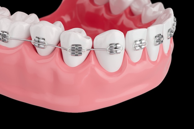 Feche os dentes de saúde do processo com cinta. foco seletivo. 3d rendem.