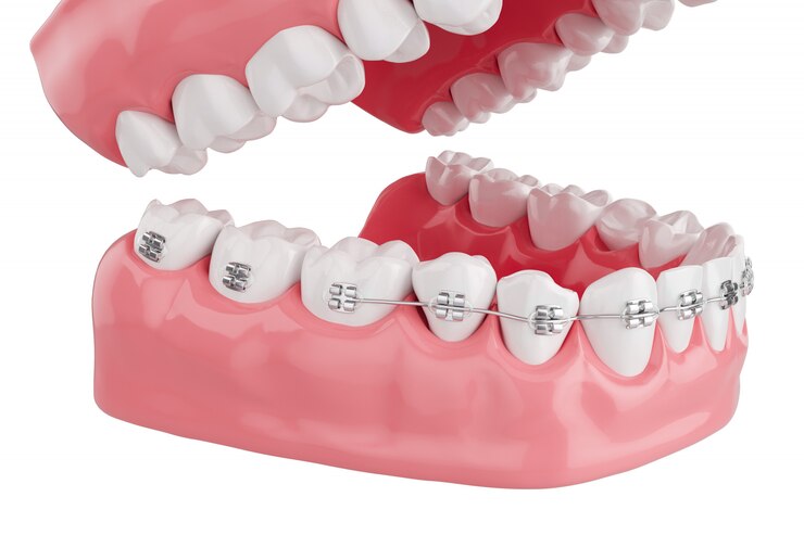 Feche os dentes de saúde do processo com cinta. Foco seletivo. 3D rendem.