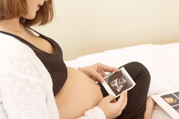 Foto feliz mujer embarazada sosteniendo la imagen de ultrasonido