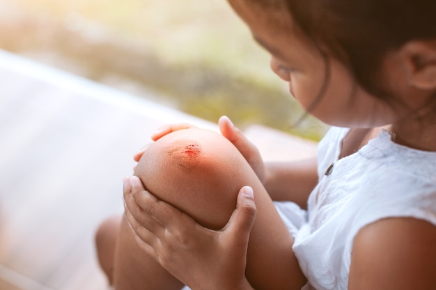 Ferida fresca e sangue de feridos no joelho da criança depois de ter sido um acidente