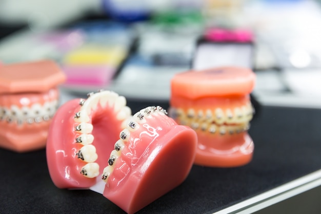 Ferramentas dentais ou ortodônticas, closeup de dentadura. gabinete de dentista, estomatologia. cuidados com os dentes, higiene da boca