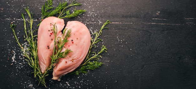 Filete de pechuga de pollo crudo con romero y especias sobre un fondo de madera negra Vista superior Espacio libre para texto