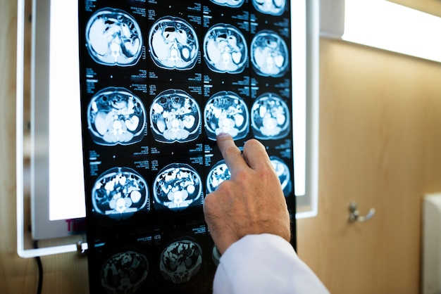 Filme de raio X de tomografia computadorizada de cérebros