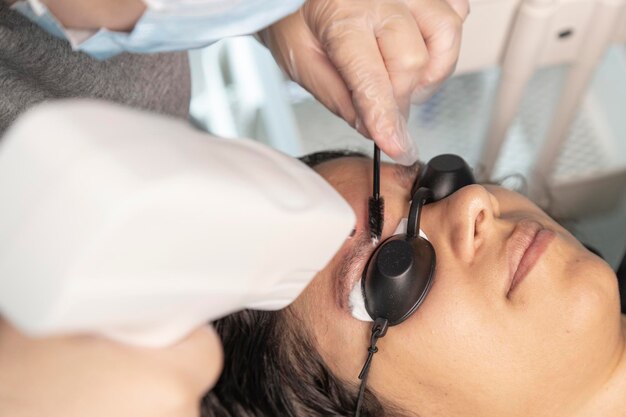 Foto finalizando remoção de tatuagem de sobrancelha com laser mulher com óculos