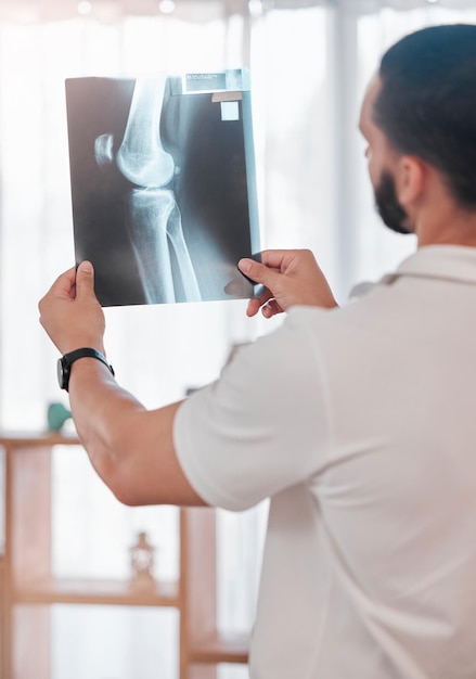 Fisioterapeuta de homem e análise de varredura de raio-x na clínica esportiva para ossos quebrados, verificação de saúde, bem-estar ou planejamento de cirurgia de lesão no joelho Imagem de raio-x do trabalhador médico ou resultados de teste para fisioterapia