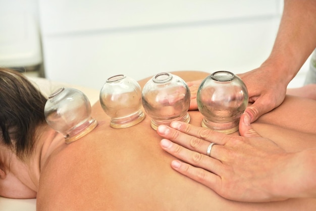 Foto fisioterapeuta feminina jovem aplicando bancos de sucção de vidro nas costas de seu paciente, durante a terapia de ventosas, detalhe de close-up.