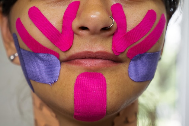 Fisioterapia de Face taping estético Retrato de mujer con konesiotape pegado