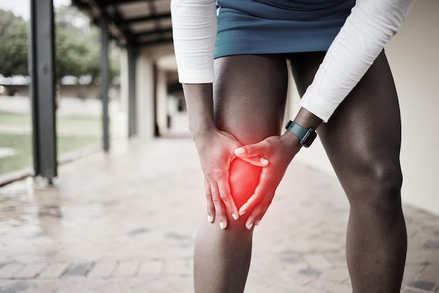 Fitness-Korbball und Knieschmerzen am Bein einer schwarzen Frau wegen Sportverletzung, Unfall und Gelenkentzündung. Trainingsübung und Notfall mit Sportlerin und Hand wegen Schmerzen und Belastung