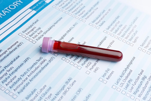 Formulario para rellenar con resultados de análisis de sangre en tubo de vidrio