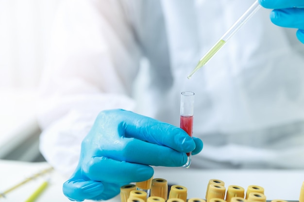 Foto forscher testen blutproben im labor forscher erfinden impfstoffe zur behandlung des covid19-virus