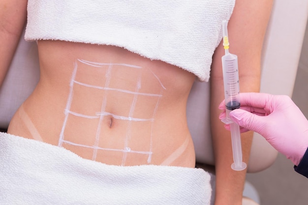 Foto foto aproximada da barriga de uma mulher, foto de procedimentos estéticos no abdômen, clínica de beleza, aplicação de ozônio, enzimas, emagrecimento, perda de peso