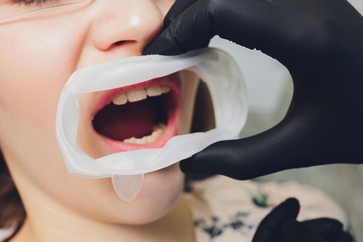 Foto foto aproximada de uma barragem de borracha dental descartável usada para manter os tecidos moles da boca protegidos da toca