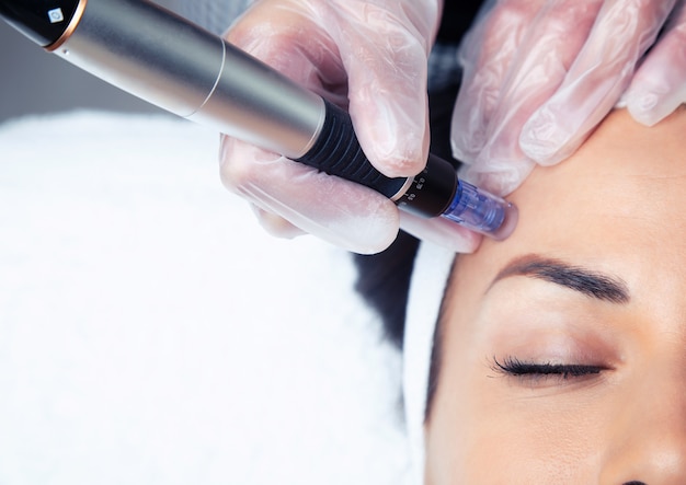 Foto de cosmetologista fazendo injeção de mesoterapia com dermapen no rosto para rejuvenescimento no centro de spa.